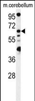 1 - MON1B Antibody  (C-term) AP17756b