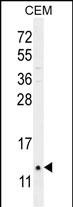 1 - C15orf37 Antibody (C-term) AP17765b