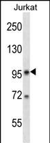 1 - SR140 Antibody (N-term) AP17774a