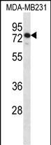 1 - SLFN12 Antibody (Center) AP17783c