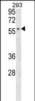 1 - MBOAT2 Antibody (Center) AP17786c