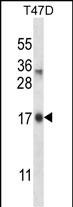 1 - IGF2AS Antibody (Center) AP17791c