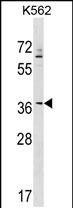 1 - ZNF385A Antibody (N-term) AP17816a
