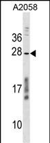 1 - CCDC144NL Antibody (C-term) AP17821b