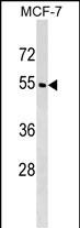 1 - WDR20 Antibody (N-term) AP17832a