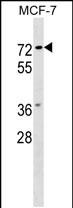 1 - NOTUM Antibody (C-term) AP17837b