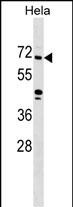 1 - ZNF280B Antibody (N-term) AP17865a