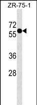 1 - ZNF503 Antibody (N-term) AP17866a