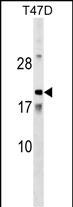 1 - AMTN Antibody (N-term) AP17897a