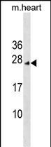 1 - INCA1 Antibody (N-term) AP17905a