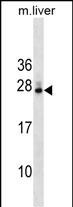 1 - DNAJB9 Antibody (N-term) AP17914A