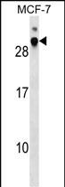 1 - DNAJB9 Antibody (N-term) AP17914A