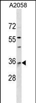 1 - RAB40A Antibody (Center) AP17918c