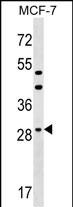 1 - DHRS11 Antibody (Center) AP17926c