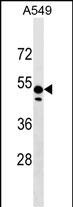 1 - ZNF695 Antibody (Center) AP17947c