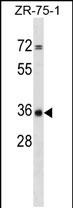 1 - CPPED1 Antibody (C-term) AP17964b