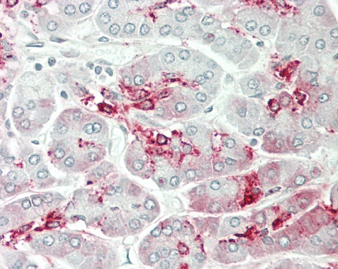 14 - GALNT9 Antibody (Center) AP17972c