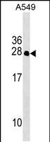 1 - IFT27 Antibody (C-term) AP17978b