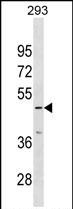 1 - IP6K3 Antibody (N-term) AP17979a