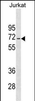 1 - JRKL Antibody (C-term) AP17980b