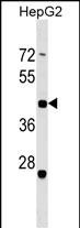 1 - ZNF547 Antibody (Center) AP17983c