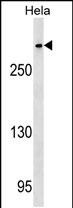 1 - CENPE Antibody (C-term) AP17985b