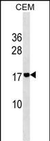 1 - ADM2 Antibody (N-term) AP18001a