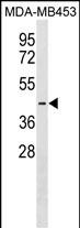 1 - PJVK Antibody (Center) AP18071c