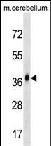 1 - MMD2 Antibody (N-term) AP18167a