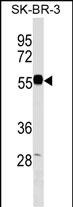 1 - EEPD1 Antibody (C-term) AP18169b