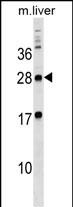 1 - MPZL3 Antibody (C-term) AP18174b