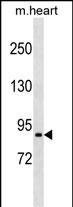 1 - PRRT4 Antibody (C-term) AP18183b