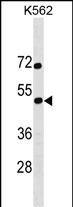 1 - SS18L1 Antibody (Center) AP18184c