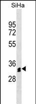 1 - OR51M1 Antibody (N-term) AP18190a