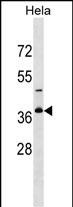 1 - GOLPH3L Antibody (Center) AP18204c