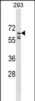 1 - PPIL2 Antibody (C-term) AP18215b