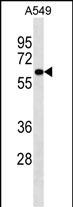 1 - PIGS Antibody (C-term) AP18217b