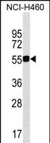 1 - QRSL1 Antibody (N-term) AP18236a