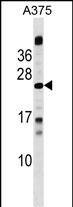 1 - MBD3L1 Antibody (C-term) AP18250b