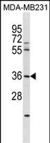1 - RNF217 Antibody (N-term) AP18251a