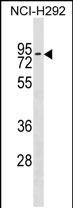 1 - ZNF551 Antibody (Center) AP18260c