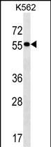 1 - FRMD8 Antibody (N-term) AP18270a