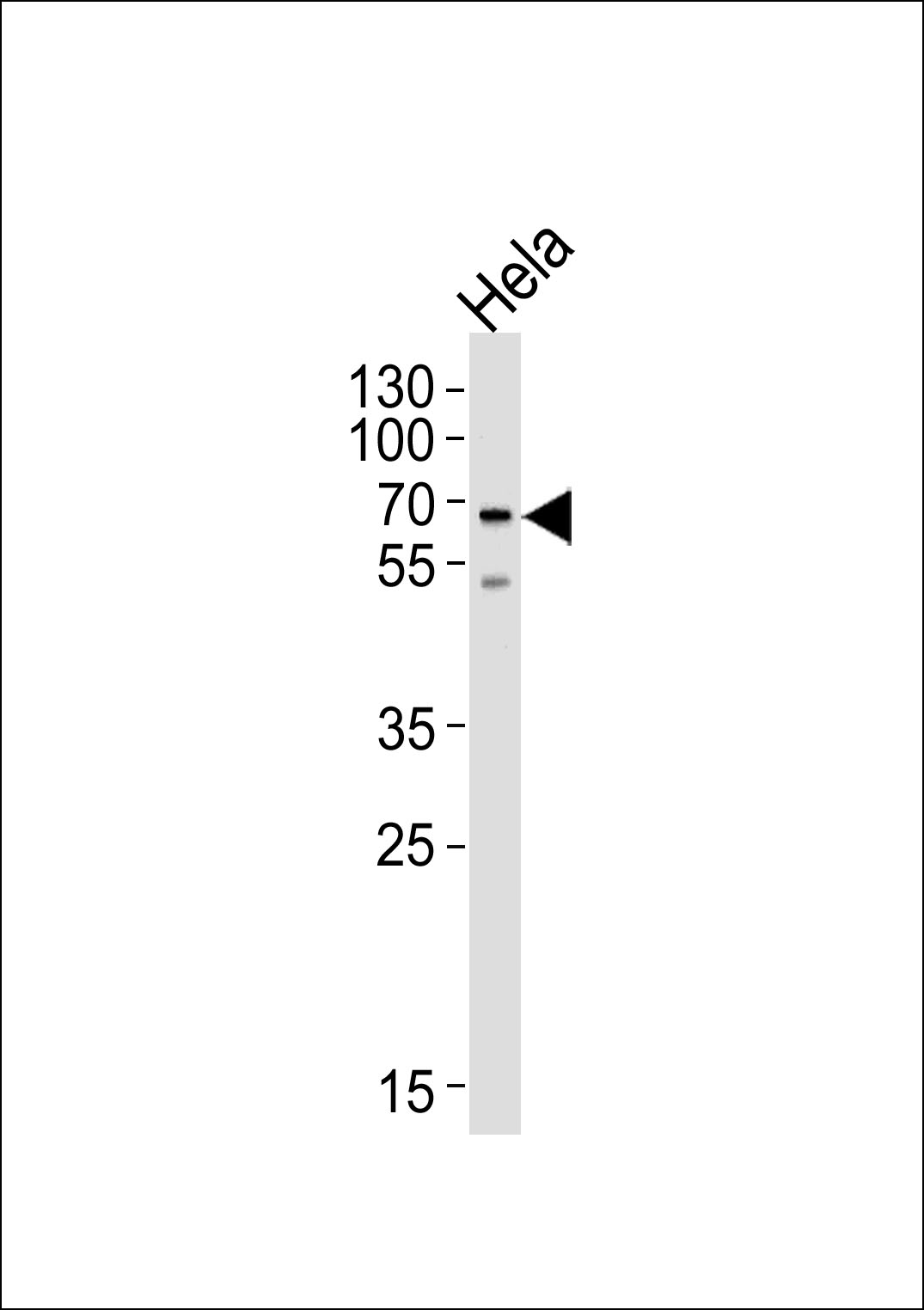 1 - NAP1L2 Antibody (N-term) AP18278a