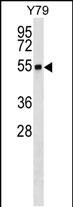 1 - RNF26 Antibody (Center) AP18283c