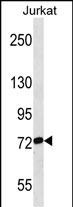 1 - RPAP3 Antibody (Center) AP18284c