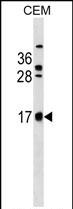 1 - CB083 Antibody (C-term) AP18329b