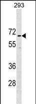 1 - CCDC151 Antibody (N-term) AP18339a