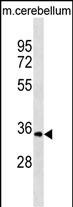1 - UCK1 Antibody (C-term) AP18359b