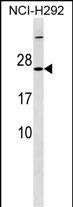 1 - MRPS23 Antibody (Center) AP18360c