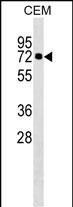 1 - KLHL28 Antibody (C-term) AP18375b